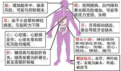 当糖尿病来“敲门”，你了解这个“不速之客”么.jpg